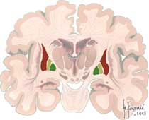 noyau lenticulaire