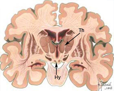 coupe sagittale Ventricule 3