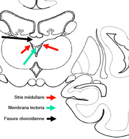 coupe coronale Ventricule 3