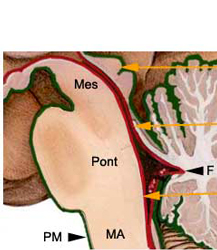 toit du quatrième ventricule