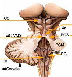 toit du quatrième ventricule