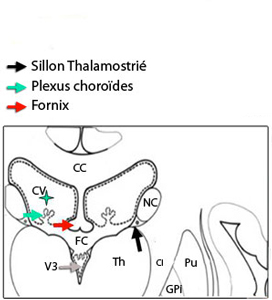 Corps ventriculaire